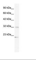 ZRANB2 / ZNF265 Antibody - HepG2 Cell Lysate.  This image was taken for the unconjugated form of this product. Other forms have not been tested.
