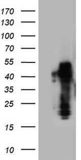 ZRANB2 / ZNF265 Antibody - HEK293T cells were transfected with the pCMV6-ENTRY control. (Left lane) or pCMV6-ENTRY ZRANB2. (Right lane) cDNA for 48 hrs and lysed. Equivalent amounts of cell lysates. (5 ug per lane) were separated by SDS-PAGE and immunoblotted with anti-ZRANB2. (1:500)