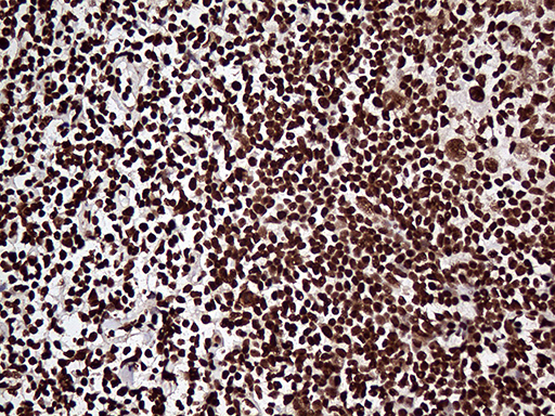 ZRANB2 / ZNF265 Antibody - Immunohistochemical staining of paraffin-embedded Human lymph node tissue within the normal limits using anti-ZRANB2 mouse monoclonal antibody. (Heat-induced epitope retrieval by 1mM EDTA in 10mM Tris buffer. (pH8.5) at 120°C for 3 min. (1:2000)
