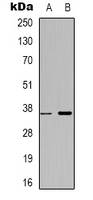 ZRANB2 / ZNF265 Antibody - Western blot analysis of ZNF265 expression in HepG2 (A); MCF7 (B) whole cell lysates.