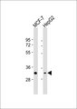 ZRANB2 / ZNF265 Antibody - All lanes: Anti-ZNF265 Antibody at 1:1000 dilution. Lane 1: MCF-7 whole cell lysate. Lane 2: HepG2 whole cell lysate Lysates/proteins at 20 ug per lane. Secondary Goat Anti-Rabbit IgG, (H+L), Peroxidase conjugated at 1:10000 dilution. Predicted band size: 37 kDa. Blocking/Dilution buffer: 5% NFDM/TBST.