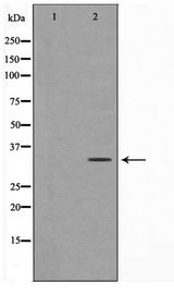 ZRANB2 / ZNF265 Antibody - Western blot of HeLa cell lysate using ZNF265 Antibody