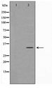 ZRANB2 / ZNF265 Antibody - Western blot of HeLa cell lysate using ZNF265 Antibody