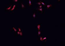 ZRANB2 / ZNF265 Antibody - Staining HeLa cells by IF/ICC. The samples were fixed with PFA and permeabilized in 0.1% Triton X-100, then blocked in 10% serum for 45 min at 25°C. The primary antibody was diluted at 1:200 and incubated with the sample for 1 hour at 37°C. An Alexa Fluor 594 conjugated goat anti-rabbit IgG (H+L) Ab, diluted at 1/600, was used as the secondary antibody.
