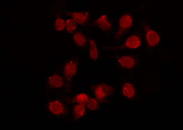 ZRANB2 / ZNF265 Antibody