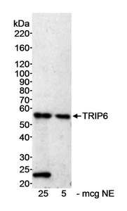 ZRP-1 / TRIP6 Antibody - Detection of Human TRIP6 by Western Blot. Samples: Nuclear extract (NE) from HeLa cells. Antibody: Affinity purified rabbit anti-TRIP6 antibody used at 0.3 ug/ml. Detection: Chemiluminescence with an exposure time of 30 minutes.
