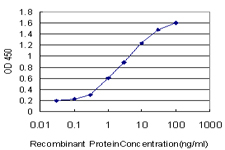 ZRP-1 / TRIP6 Antibody - Detection limit for recombinant GST tagged TRIP6 is approximately 0.1 ng/ml as a capture antibody.