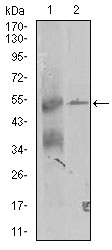 ZRP-1 / TRIP6 Antibody - Western blot using TRIP6 mouse monoclonal antibody against K562 and A431 (2) cell lysate.