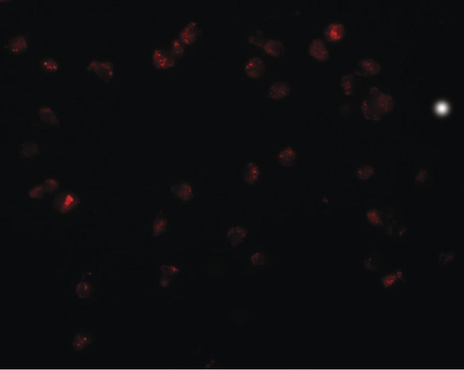 ZRP-1 / TRIP6 Antibody - Immunofluorescence of TRIP6 in HeLa cells with TRIP6 antibody at 20 ug/ml.
