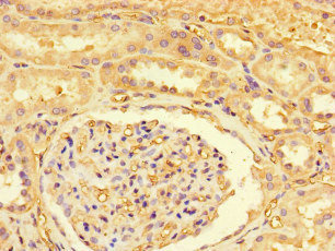 ZRSR1 Antibody - Immunohistochemistry of paraffin-embedded human kidney tissue at dilution of 1:100