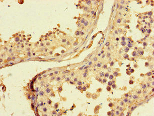 ZRSR1 Antibody - Immunohistochemistry of paraffin-embedded human testis tissue at dilution of 1:100