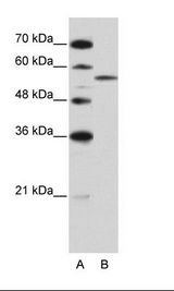 ZRSR2 Antibody - A: Marker, B: HepG2 Cell Lysate.  This image was taken for the unconjugated form of this product. Other forms have not been tested.