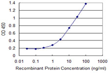 ZRSR2 Antibody - Detection limit for recombinant GST tagged ZRSR2 is 0.1 ng/ml as a capture antibody.
