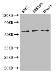ZRSR2 Antibody - Positive WB detected in:K562 whole cell lysate,HEK293 whole cell lysate,Mouse heart tissue;All lanes: ZRSR2 antibody at 3ug/ml;Secondary;Goat polyclonal to rabbit IgG at 1/50000 dilution;Predicted band size: 59 kDa;Observed band size: 59 kDa;