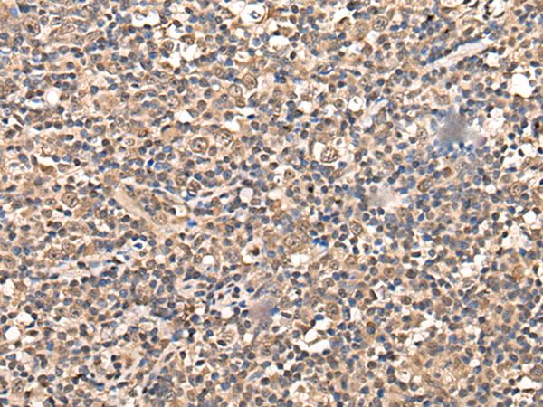 ZSCAN12 Antibody - Immunohistochemistry of paraffin-embedded Human tonsil tissue  using ZSCAN12 Polyclonal Antibody at dilution of 1:50(×200)