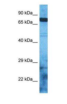 ZSCAN12 Antibody - Western blot of ZSC12 Antibody with human RPMI-8226 Whole Cell lysate.  This image was taken for the unconjugated form of this product. Other forms have not been tested.