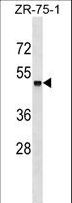 ZSCAN18 / ZNF447 Antibody - ZSCAN18 Antibody western blot of ZR-75-1 cell line lysates (35 ug/lane). The ZSCAN18 antibody detected the ZSCAN18 protein (arrow).