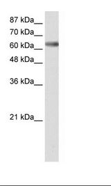 ZSCAN18 / ZNF447 Antibody - Transfected 293T Cell Lysate.  This image was taken for the unconjugated form of this product. Other forms have not been tested.