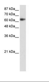 ZSCAN18 / ZNF447 Antibody - Transfected 293T Cell Lysate.  This image was taken for the unconjugated form of this product. Other forms have not been tested.