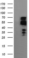 ZSCAN18 / ZNF447 Antibody - HEK293T cells were transfected with the pCMV6-ENTRY control (Left lane) or pCMV6-ENTRY ZSCAN18 (Right lane) cDNA for 48 hrs and lysed. Equivalent amounts of cell lysates (5 ug per lane) were separated by SDS-PAGE and immunoblotted with anti-ZSCAN18.