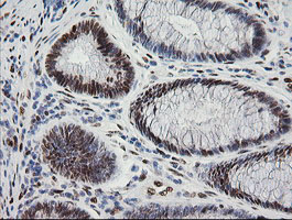 ZSCAN18 / ZNF447 Antibody - IHC of paraffin-embedded Human colon tissue using anti-ZSCAN18 mouse monoclonal antibody.