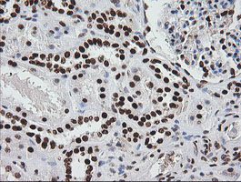 ZSCAN18 / ZNF447 Antibody - IHC of paraffin-embedded Human Kidney tissue using anti-ZSCAN18 mouse monoclonal antibody.