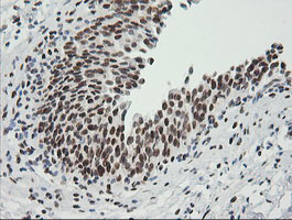 ZSCAN18 / ZNF447 Antibody - IHC of paraffin-embedded Human bladder tissue using anti-ZSCAN18 mouse monoclonal antibody.
