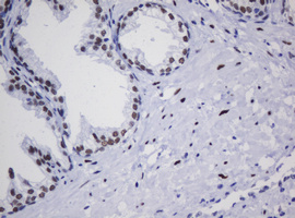 ZSCAN18 / ZNF447 Antibody - IHC of paraffin-embedded Human prostate tissue using anti-ZSCAN18 mouse monoclonal antibody.