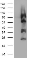 ZSCAN18 / ZNF447 Antibody - HEK293T cells were transfected with the pCMV6-ENTRY control (Left lane) or pCMV6-ENTRY ZSCAN18 (Right lane) cDNA for 48 hrs and lysed. Equivalent amounts of cell lysates (5 ug per lane) were separated by SDS-PAGE and immunoblotted with anti-ZSCAN18.