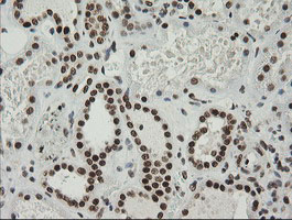 ZSCAN18 / ZNF447 Antibody - IHC of paraffin-embedded Human Kidney tissue using anti-ZSCAN18 mouse monoclonal antibody.