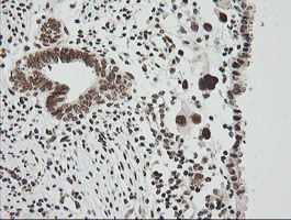 ZSCAN18 / ZNF447 Antibody - IHC of paraffin-embedded Human endometrium tissue using anti-ZSCAN18 mouse monoclonal antibody.
