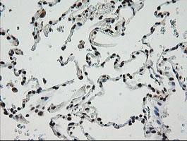 ZSCAN18 / ZNF447 Antibody - IHC of paraffin-embedded Human lung tissue using anti-ZSCAN18 mouse monoclonal antibody.