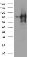 ZSCAN18 / ZNF447 Antibody - HEK293T cells were transfected with the pCMV6-ENTRY control (Left lane) or pCMV6-ENTRY ZSCAN18 (Right lane) cDNA for 48 hrs and lysed. Equivalent amounts of cell lysates (5 ug per lane) were separated by SDS-PAGE and immunoblotted with anti-ZSCAN18.