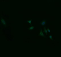 ZSCAN18 / ZNF447 Antibody - Immunofluorescent staining of HeLa cells using anti-ZSCAN18 mouse monoclonal antibody.