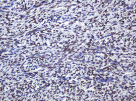 ZSCAN18 / ZNF447 Antibody - IHC of paraffin-embedded Human Ovary tissue using anti-ZSCAN18 mouse monoclonal antibody.