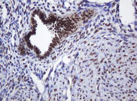 ZSCAN18 / ZNF447 Antibody - IHC of paraffin-embedded Human endometrium tissue using anti-ZSCAN18 mouse monoclonal antibody.
