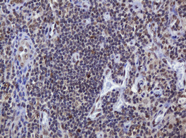 ZSCAN18 / ZNF447 Antibody - IHC of paraffin-embedded Human lymph node tissue using anti-ZSCAN18 mouse monoclonal antibody.
