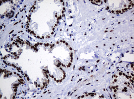 ZSCAN18 / ZNF447 Antibody - IHC of paraffin-embedded Human prostate tissue using anti-ZSCAN18 mouse monoclonal antibody.