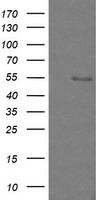 ZSCAN18 / ZNF447 Antibody - HEK293T cells were transfected with the pCMV6-ENTRY control (Left lane) or pCMV6-ENTRY ZSCAN18 (Right lane) cDNA for 48 hrs and lysed. Equivalent amounts of cell lysates (5 ug per lane) were separated by SDS-PAGE and immunoblotted with anti-ZSCAN18.