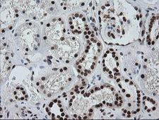 ZSCAN18 / ZNF447 Antibody - IHC of paraffin-embedded Human Kidney tissue using anti-ZSCAN18 mouse monoclonal antibody. (Heat-induced epitope retrieval by 10mM citric buffer, pH6.0, 120°C for 3min).