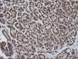 ZSCAN18 / ZNF447 Antibody - IHC of paraffin-embedded Human pancreas tissue using anti-ZSCAN18 mouse monoclonal antibody. (Heat-induced epitope retrieval by 10mM citric buffer, pH6.0, 120°C for 3min).