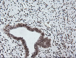 ZSCAN18 / ZNF447 Antibody - IHC of paraffin-embedded Human endometrium tissue using anti-ZSCAN18 mouse monoclonal antibody. (Heat-induced epitope retrieval by 10mM citric buffer, pH6.0, 120°C for 3min).