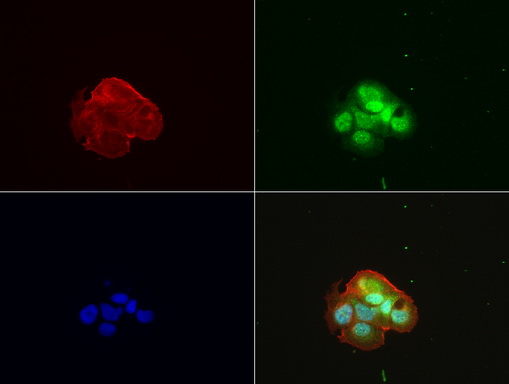 ZSCAN18 / ZNF447 Antibody - Immunofluorescent staining of MCF-7 cells using anti-ZSCAN18 mouse monoclonal antibody  green, 1:100). Actin filaments were labeled with Alexa Fluor® 594 Phalloidin. (red), and nuclear with DAPI. (blue).