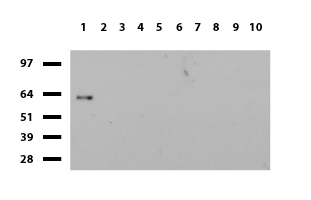 ZSCAN18 / ZNF447 Antibody - Western blot of human tissue lysates. (15ug) from 10 different tissues. (1: Testis, 2: Omentum, 3: Uterus, 4: Breast, 5: Brain, 6: Thyroid, 7: Colon, 8: Spleen 9: Liver, 10: Ovary). Diluation: 1:500.