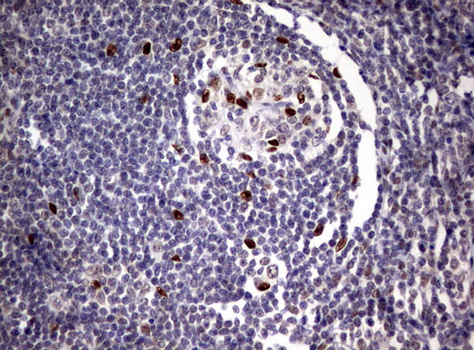 ZSCAN18 / ZNF447 Antibody - Immunohistochemical staining of paraffin-embedded Human tonsil using anti-ZSCAN18 mouse monoclonal antibody.  heat-induced epitope retrieval by 10mM citric buffer, pH6.0, 120C for 3min)