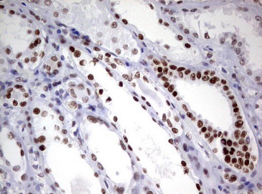 ZSCAN18 / ZNF447 Antibody - Immunohistochemical staining of paraffin-embedded Human Kidney tissue using anti-ZSCAN18 mouse monoclonal antibody.  heat-induced epitope retrieval by 10mM citric buffer, pH6.0, 120C for 3min)