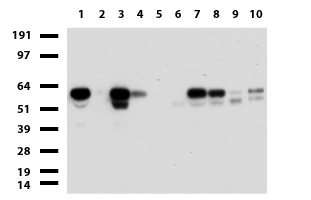 ZSCAN18 / ZNF447 Antibody - Western blot of human tissue lysates. (15ug) from 10 different tissues. (1: Testis, 2: Omentum, 3: Uterus, 4: Breast, 5: Brain, 6: Liver, 7: Ovary, 8: Colon, 9: Spleen, 10: Thyroid). Diluation: 1:500.