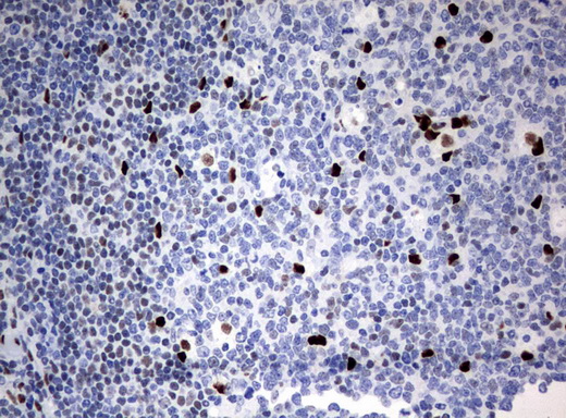 ZSCAN18 / ZNF447 Antibody - Immunohistochemical staining of paraffin-embedded Human lymph node tissue using anti-ZSCAN18 mouse monoclonal antibody.  heat-induced epitope retrieval by 10mM citric buffer, pH6.0, 120C for 3min)