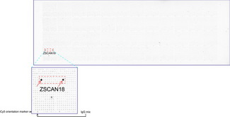 ZSCAN18 / ZNF447 Antibody - OriGene overexpression protein microarray chip was immunostained with UltraMAB anti-ZSCAN18 mouse monoclonal antibody. The positive reactive proteins are highlighted with two red arrows in the enlarged subarray. All the positive controls spotted in this subarray are also labeled for clarification.