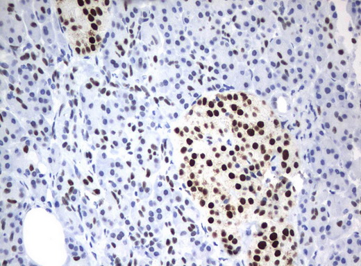 ZSCAN18 / ZNF447 Antibody - Immunohistochemical staining of paraffin-embedded Human pancreas tissue using anti-ZSCAN18 mouse monoclonal antibody.  heat-induced epitope retrieval by 10mM citric buffer, pH6.0, 120C for 3min)